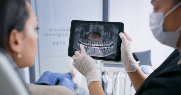 Licensed Teeth Whitening service in San Buenaventura, CA - Smile Center Dentistry